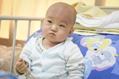 新生儿血小板偏低