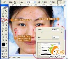 什么软件可以去痘痘