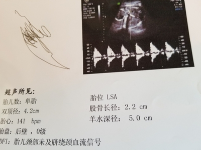 孕19周胎儿双顶径标准