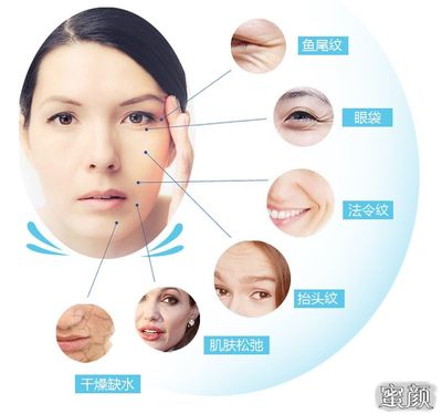 胶原蛋白填充法令纹