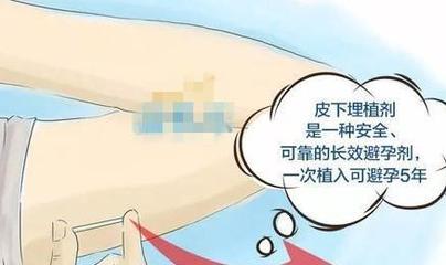 一直戴套还是怀孕了