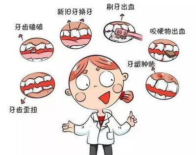 乳牙掉时出血怎么处理