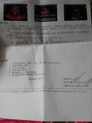 现在怀孕8周几月份生