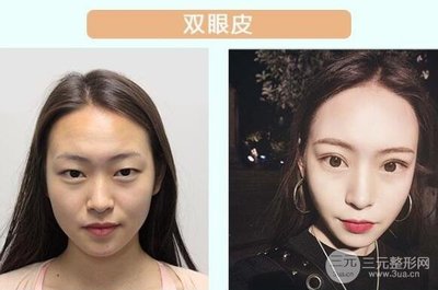 那个名星做过双眼皮