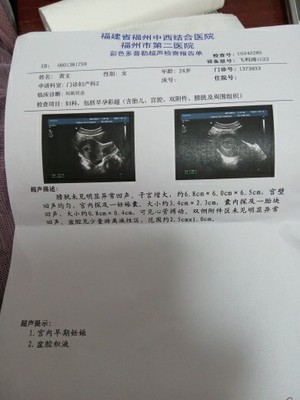 一般几天会怀孕
