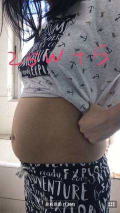 6个月孕肚