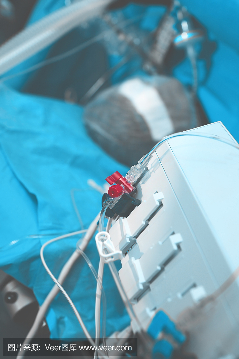 手术台上的病人连接着呼吸机和其他数码设备