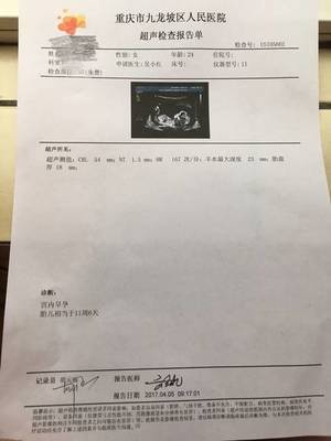 怀孕30多天有什么反应