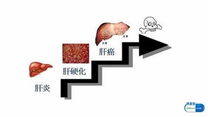 肝炎怎么治疗最好的方法