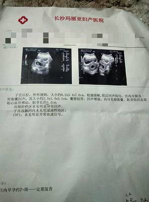 怀孕着床晚是什么意思