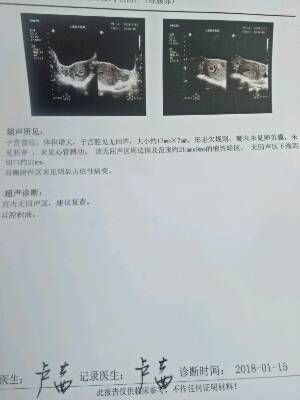 怀孕四十五天有什么反应