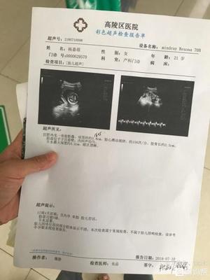 胎儿发育小