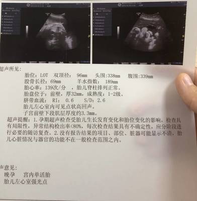 一般几天会怀孕