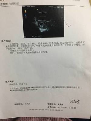 怀孕多久做一次产检