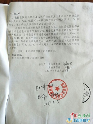 法医鉴定轻微伤标准