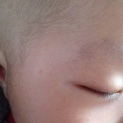 新生儿白点点是什么