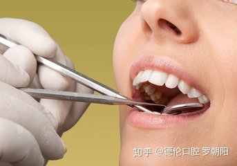拔牙后多久恢复正常