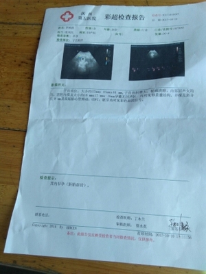 移植多少天有卵黄囊