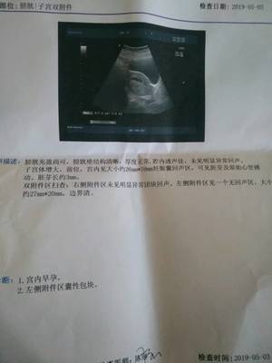 一根输卵管能怀孕吗