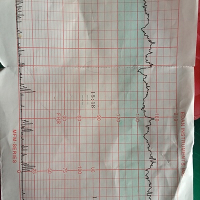 30秒心跳多少算正常吗