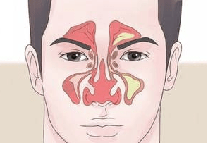 上颚有血丝是怎么回事