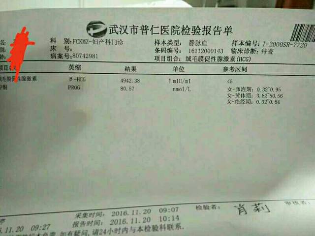 刚怀孕屁多正常吗