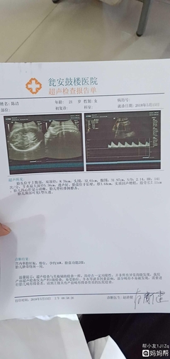 怀孕35周还有多久生产