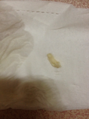 排卵期有白色豆腐渣样