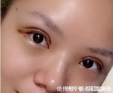 双眼皮什么时候贴