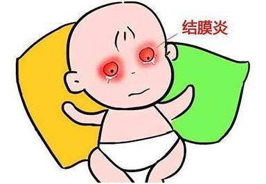 3岁宝宝结膜炎怎么办