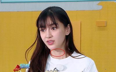 熬夜脖子后面长痘痘怎么办