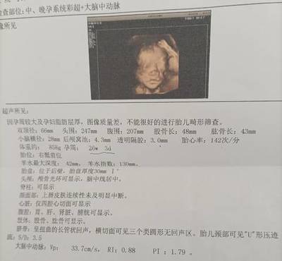 小排畸有宝宝照片吗