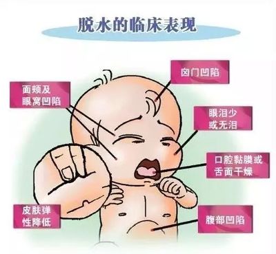 宝宝卤门在什么位置