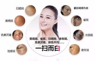 皮秒祛斑对皮肤有伤害吗