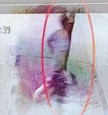 梦见被别人拿刀追杀