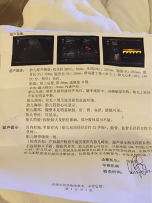 孕32周出血是怎么回事