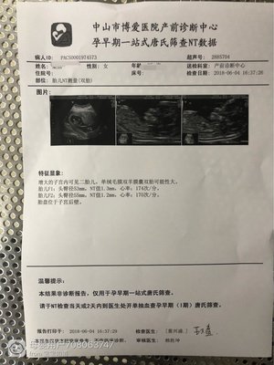nt筛查的费用多少钱