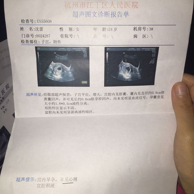 怀孕初期出血褐色少量