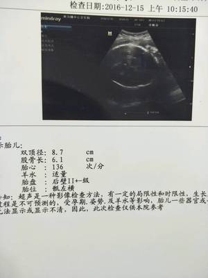 怀孕3个半月胎儿有多大