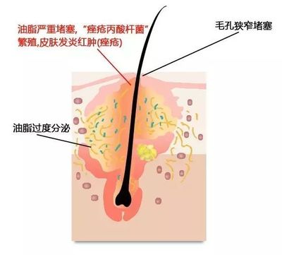 毛孔英文
