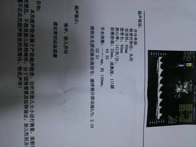 33周宝宝4斤正常吗