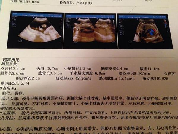 怀孕36周是多少个月