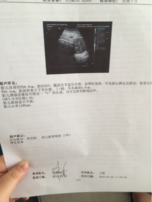 如何检查胎儿是否入盆