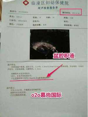 输卵管一边堵塞一边通会怀孕吗