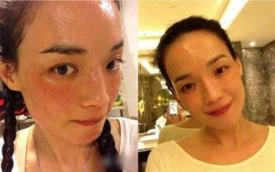 痘痘脸 粉底液