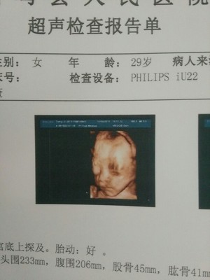 刚怀孕抽血需要空腹吗