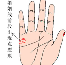 婚姻线4条
