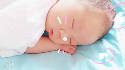 怀孕两个月头疼