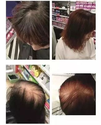 哺乳期六个月可以染头发吗