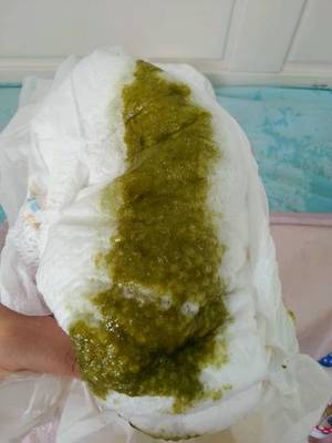 宝宝拉粑粑绿色